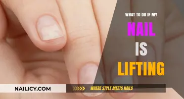 Nail Lifting? Quick Fixes and Prevention Tips for Healthy Nails
