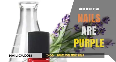 Purple Nails? Causes, Concerns, and Quick Remedies to Try Now