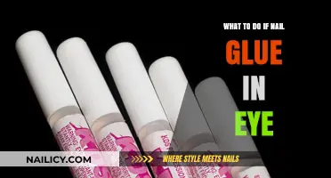 Nail Glue in Eye: Quick Steps to Safely Remove and Treat