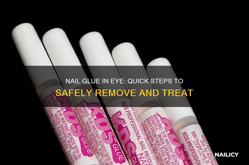 what to do if nail glue in eye