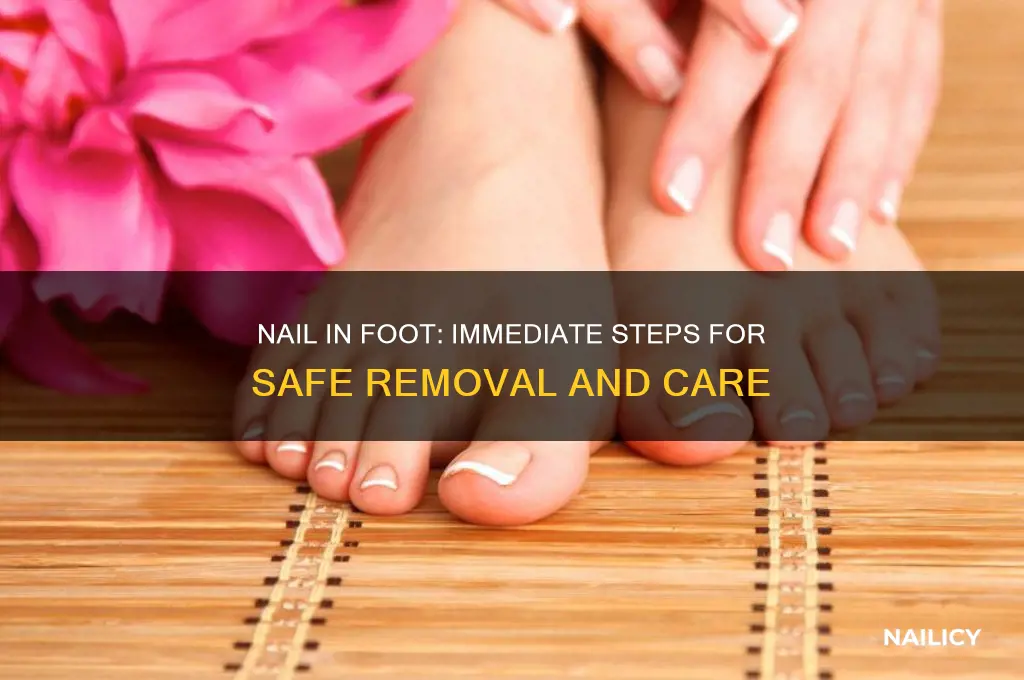 what to do if nail goes in foot