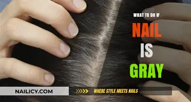 Gray Nail Concerns: Causes, Treatments, and When to Seek Help