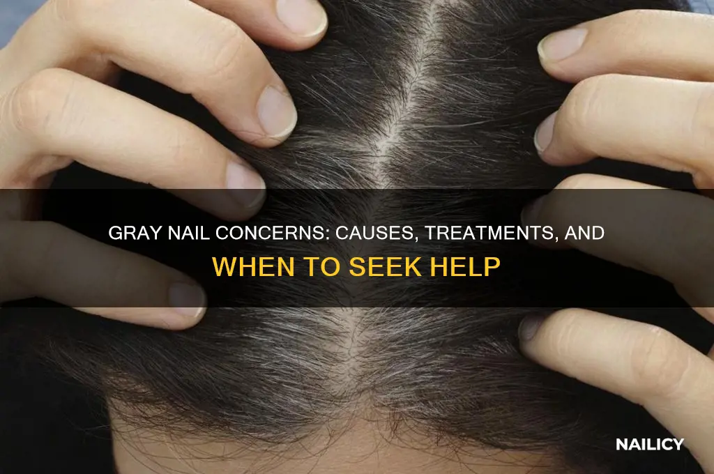 what to do if nail is gray