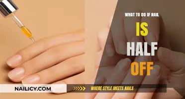 Nail Half Off? Quick Fixes and Care Tips to Save It