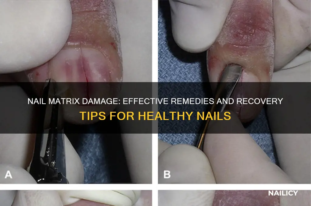 what to do if nail matrix is damaged