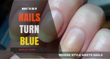 Blue Nails? Causes, Concerns, and Quick Remedies to Try Now