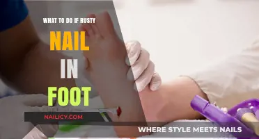 Rusty Nail in Foot: Immediate Steps and Treatment Guide