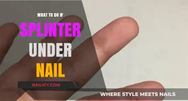 Splinter Under Nail? Quick Relief Tips and Home Remedies