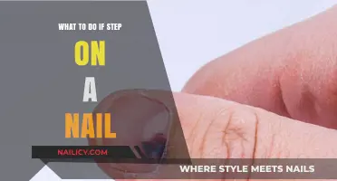 Stepped on a Nail? Immediate Steps to Prevent Infection and Heal