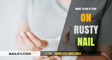 Stepped on a Rusty Nail? Immediate Steps to Prevent Infection