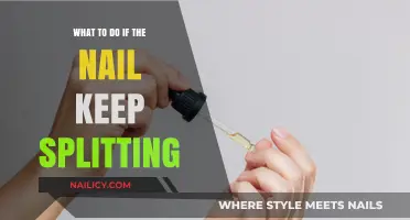 How to Prevent and Treat Constantly Splitting Nails: Expert Tips