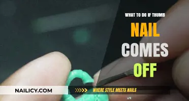 Thumb Nail Emergency: Quick Steps to Handle a Lost Nail