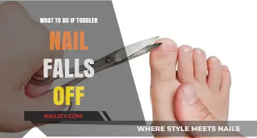 Toddler Nail Falls Off: Quick Care Tips and What to Do