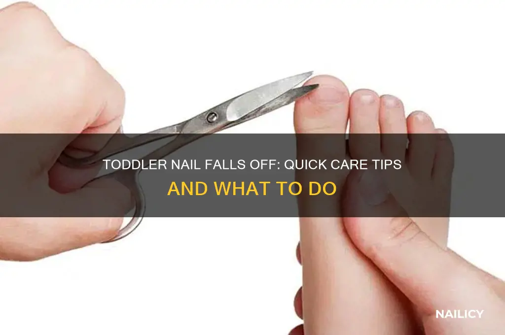what to do if toddler nail falls off