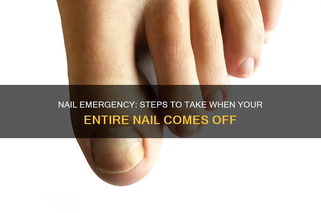 what to do if whole nail comes off