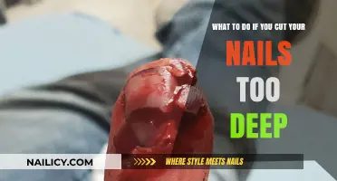 Nail-Cutting Oopsies: Quick Fixes for Over-Trimmed Nails