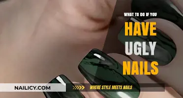 Transform Ugly Nails: Simple Tips for Healthy, Beautiful Hands