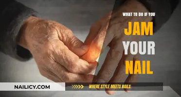 Ouch! Jammed Nail? Quick Relief and Recovery Tips Inside