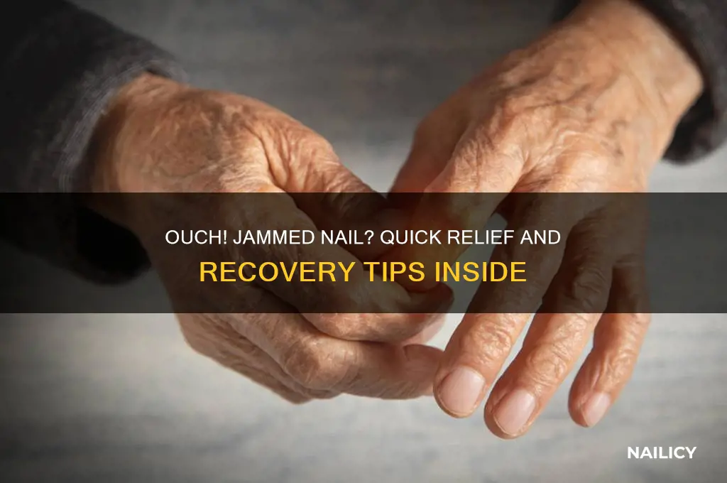 what to do if you jam your nail