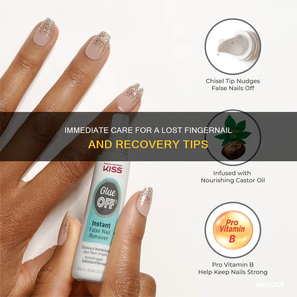 what to do if you lose a finger nail