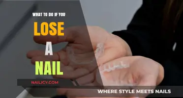 Quick Fixes and Care Tips for a Lost Nail Emergency