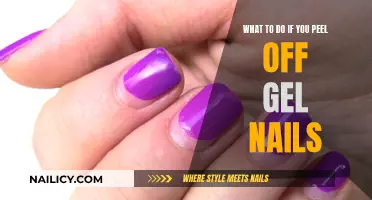 Gel Nails Peeled Off? Here's What You Can Do