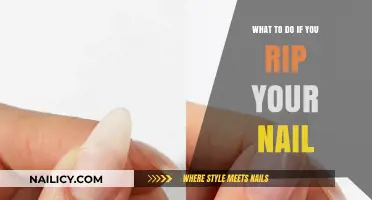 Quick Fixes for a Ripped Nail: Pain Relief and Repair Tips