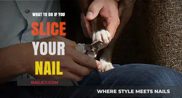 Quick Fix for a Sliced Nail: Emergency Care and Recovery Tips