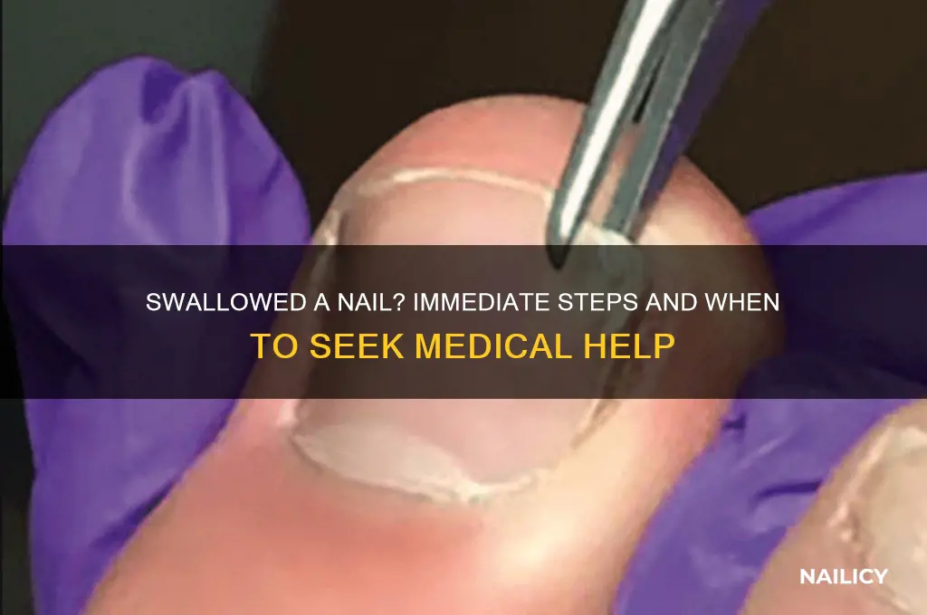 what to do if you swallow a nail