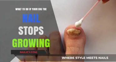 Big Toe Nail Stopped Growing? Try These Remedies