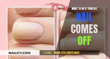 Gel Nail Emergency: Quick Fixes for a Popped-off Nail