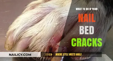 Cracked Nail Bed? Quick Fixes and Healing Tips for Relief