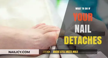 Nail Detachment: Quick Steps to Treat and Prevent Further Damage