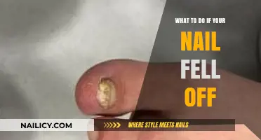 Nail Fell Off? Quick Healing Tips and Care Guide