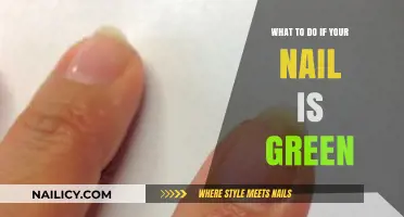 Green Nail Alert: Quick Fixes and Prevention Tips for Healthy Nails