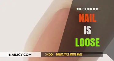 Loose Nail? Quick Fixes and Care Tips for Healthy Recovery