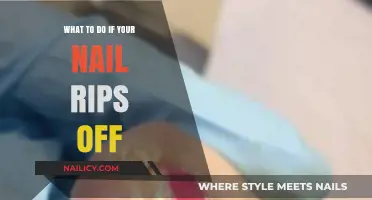 Nail Emergency: Quick Steps to Heal a Ripped Nail Safely