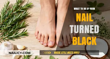 Black Nail? Causes, Concerns, and Quick Remedies to Try Now