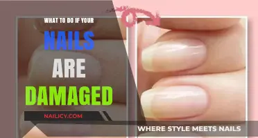 Revive Your Damaged Nails: Effective Tips for Healthy, Strong Growth