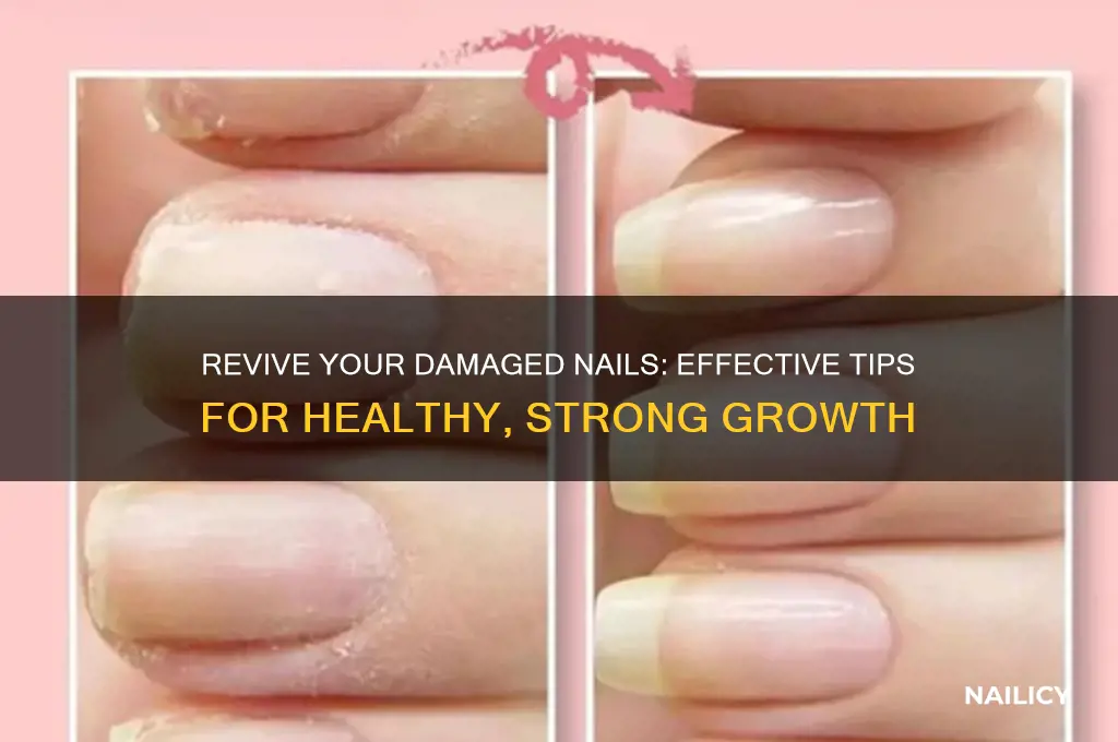 what to do if your nails are damaged
