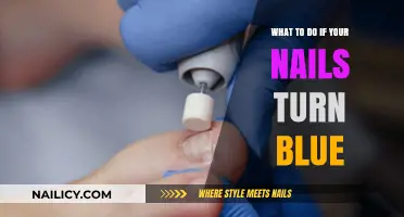 Blue Nails? Causes, Concerns, and Quick Remedies to Try Now