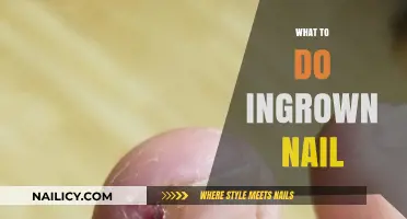Effective Remedies and Prevention Tips for Painful Ingrown Toenails