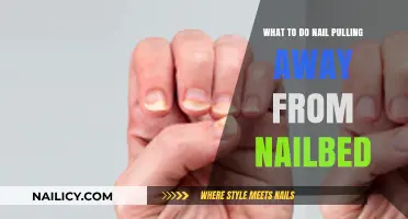 Nail Separation: Effective Remedies for Nails Pulling Away from Nail Bed
