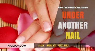 Fixing Ingrown Nails: What You Should Do