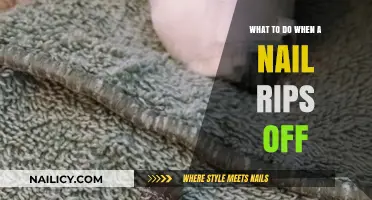 Nail Ripped Off? Quick Steps for Pain Relief and Healing