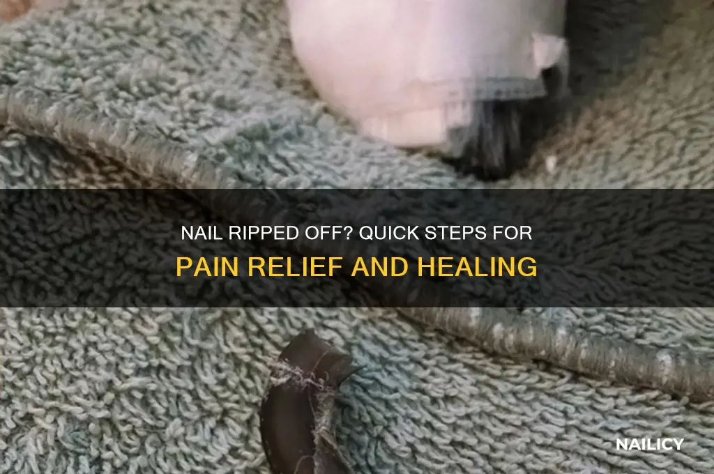 what to do when a nail rips off