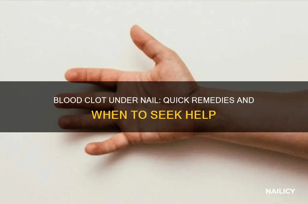 what to do when blood clot in nail
