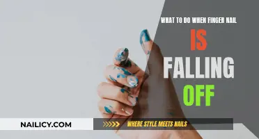 How to Care for a Falling Fingernail