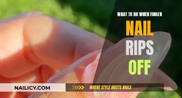 How to Treat a Ripped Fingernail at Home
