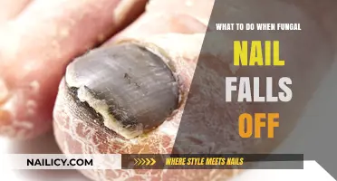 Fungal Nail Fallen Off? Essential Aftercare Tips for Healthy Recovery